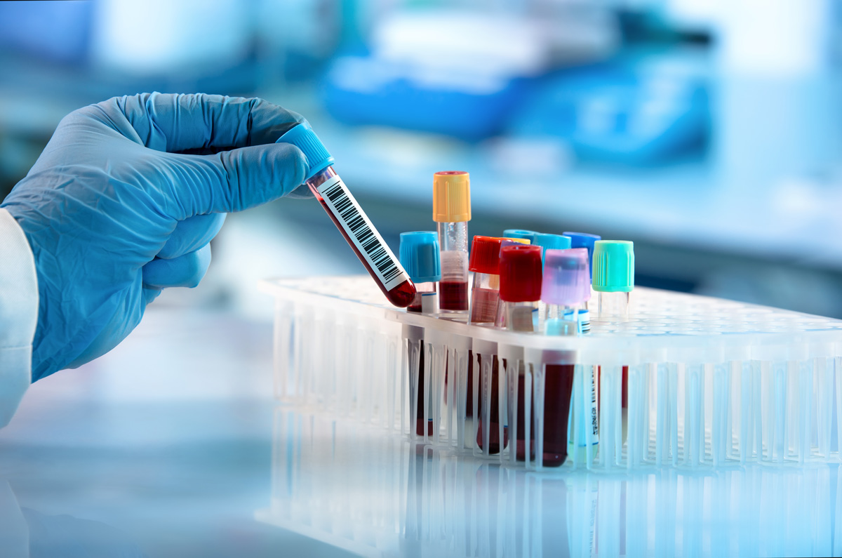 A hand picking up tubes of blood from lab testing in El Paso.